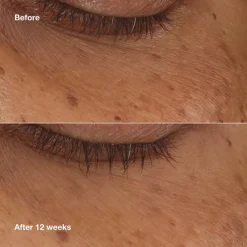 CLINIQUE All About Eyes Sérum Concentrado Iluminador