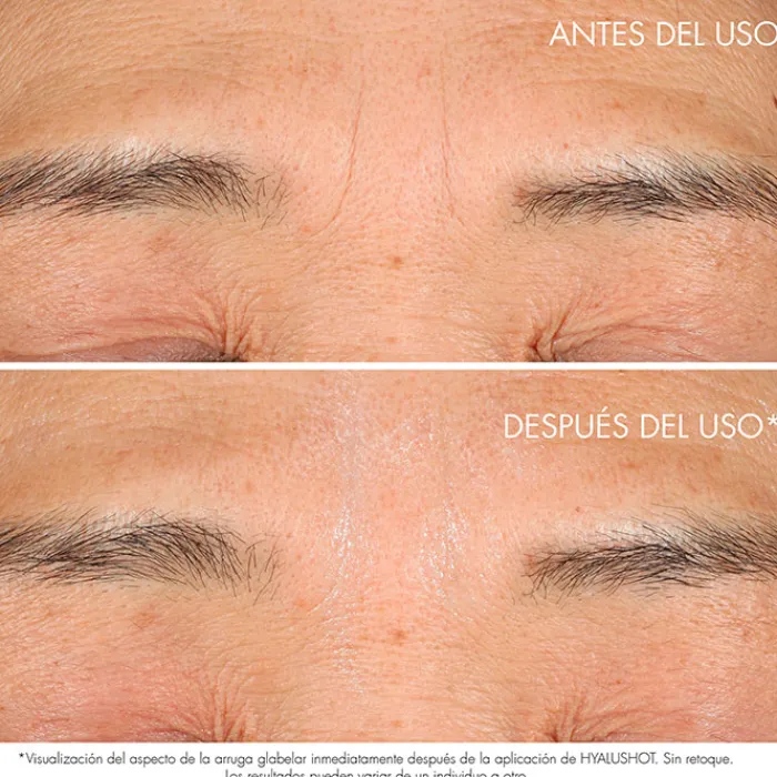 Dior CAPTURE TOTALE HYALUSHOT