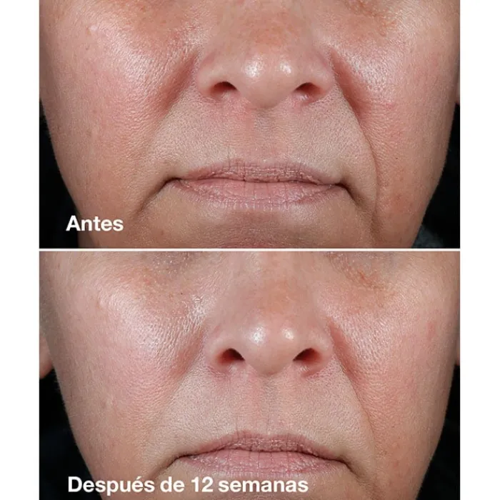 CLINIQUE Smart Clinical Repair Rich Cream