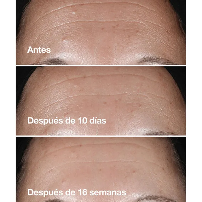 CLINIQUE Smart Clinical Repair Wrinkle Correcting Serum