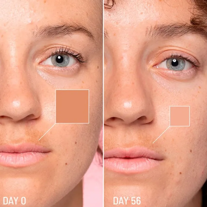 Freshly Cosmetics Lotus Radiance Dark Spot Treatment