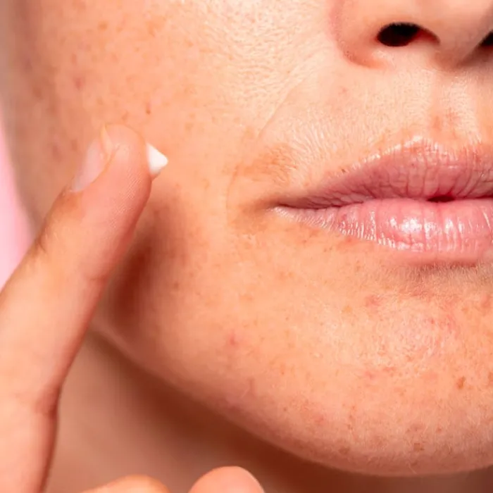 Freshly Cosmetics Lotus Radiance Dark Spot Treatment