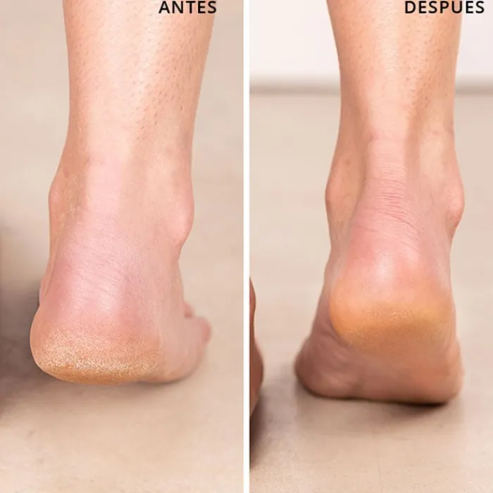 Freshly Cosmetics Vegan Hero All-Purpose Balm