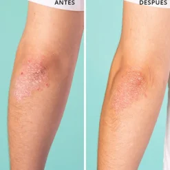 Freshly Cosmetics Vegan Hero All-Purpose Balm